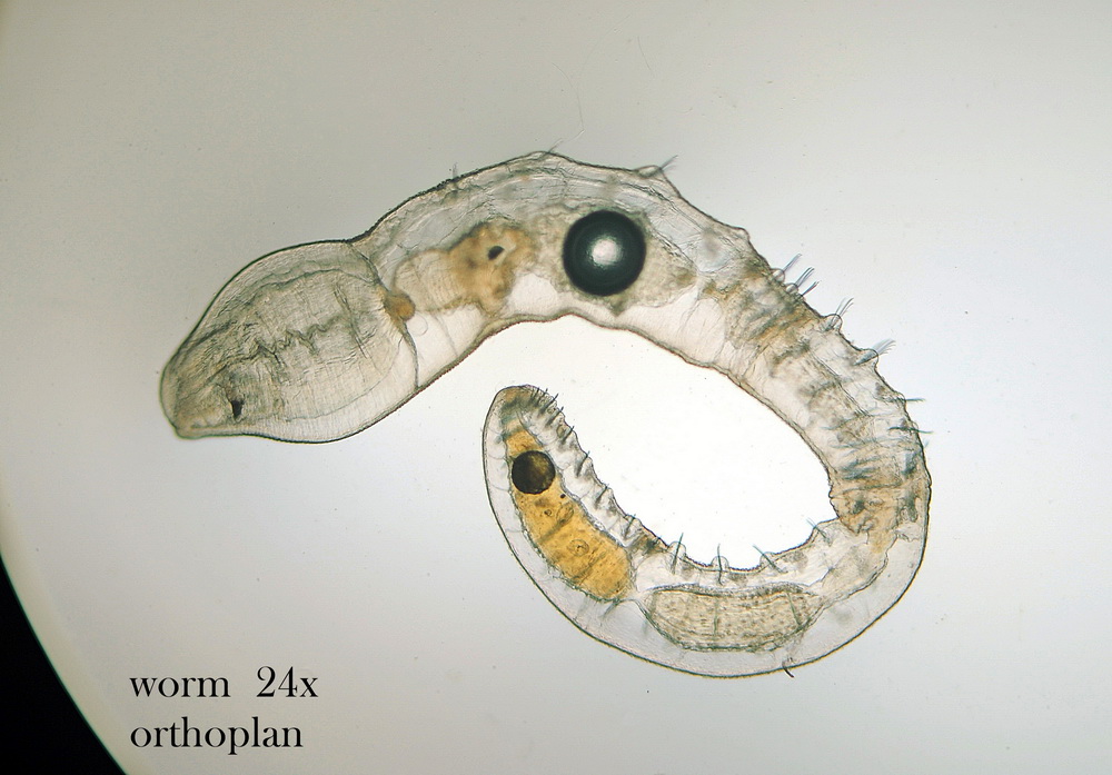 Verme fotogenico, credo sia un nematode.